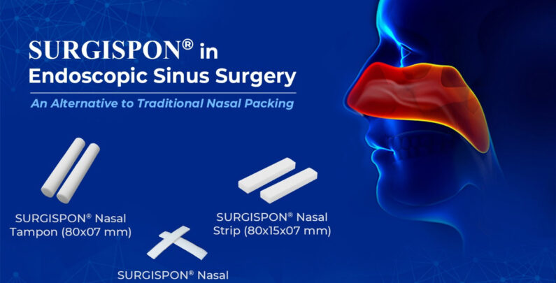 SURGISPON® in Endoscopic Sinus Surgery: An Alternative to Traditional Nasal Packing