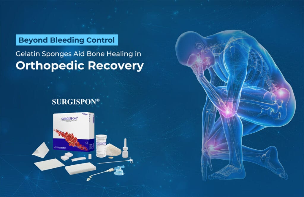 Gelatin Sponges Aid Bone Healing in Orthopedic Recovery
