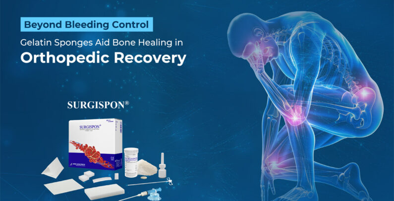 Gelatin Sponges Aid Bone Healing in Orthopedic Recovery