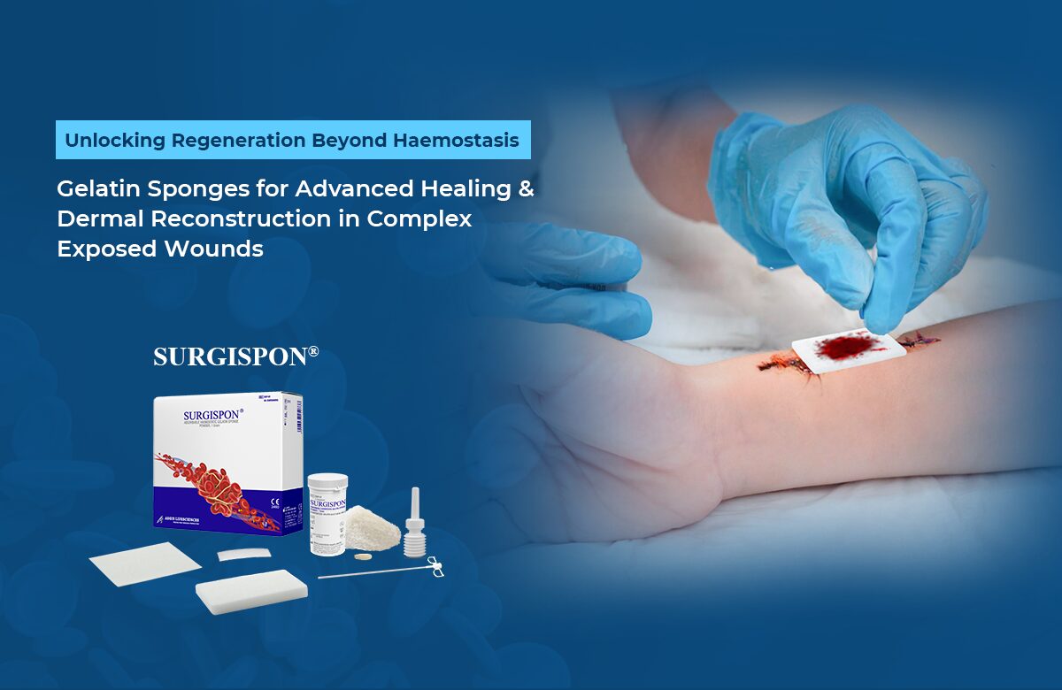 Gelatin sponge for advanced wound healing and dermal tissue regeneration beyond haemostasis