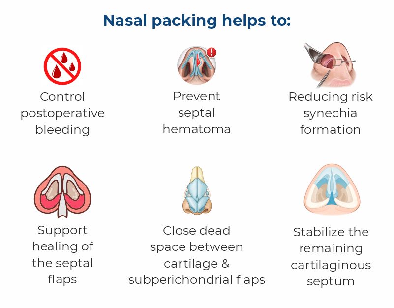 Nasal packing benefits after septoplasty including bleeding control and septal stabilization