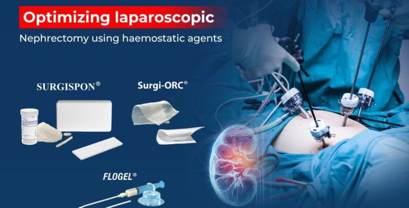 Laparoscopic nephrectomy procedure using advanced haemostatic agents for surgical bleeding control and improved patient outcomes