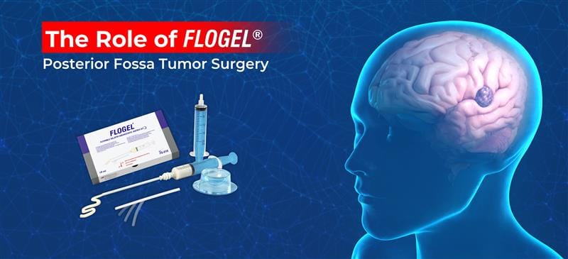FLOGEL posterior fossa tumor surgery