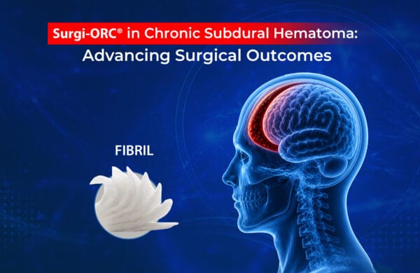 Surgi-ORC® in Chronic Subdural Hematoma