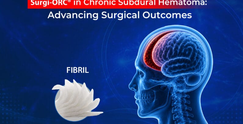 Surgi-ORC® in Chronic Subdural Hematoma