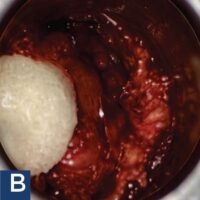B SURGERY B SURGERY