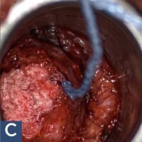 C SURGERY C SURGERY