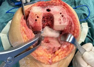 SURGERY IMAGE 1 SURGERY IMAGE 1