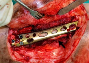 SURGERY-IMAGE-1 SURGERY-IMAGE-1