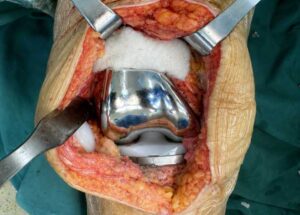 SURGERY IMAGE 2 SURGERY IMAGE 2
